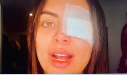 La tragedia de la modelo Laura González: ¿perdió un ojo por vanidad?