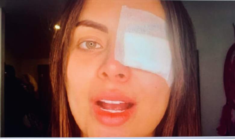 Modelo Laura González casi pierde el ojo por procedimiento estético: VIDEO