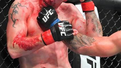 Campeón de la UFC comparte fotografía en la que se ve un trozo de su pulmón [IMÁGENES FUERTES]