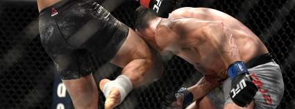 MMA: Víctima de un rodillazo ilegal estremece las redes con una foto de cómo quedó su ojo [IMÁGENES FUERTES]