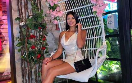 Las fotos que muestran a Ana Parra en llamas