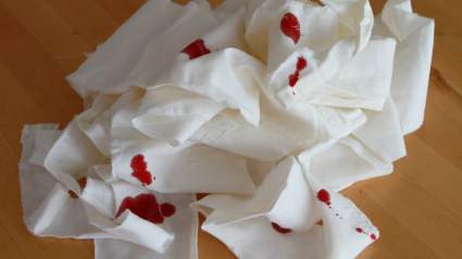 Véalo: ‘Real Housewives’ Star Suffers ‘Scary’ Head Lesiones