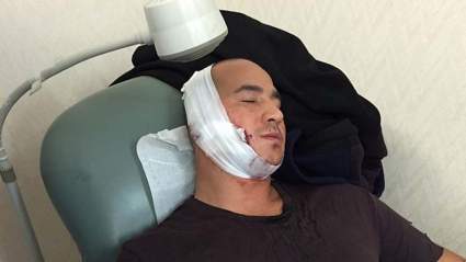 London Rene apuñalado: 5 hechos rápidos que necesita saber